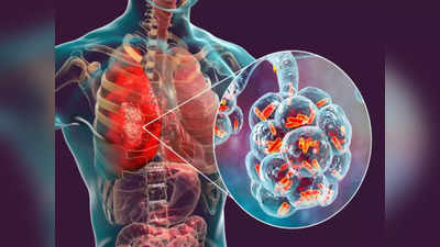 Tuberculosis: ಕೊರೊನಾಗಿಂತ ಕ್ಷಯ ರೋಗ ಅಪಾಯ- ಡಾ. ರಾಜೇಂದ್ರ