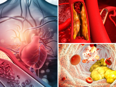 How To Lower Cholesterol: रक्तातील घाणेरडे कोलेस्ट्रॉल गाळून बाहेर फेकतात हे ५ पदार्थ, LDL रक्तात पोहचत नाही