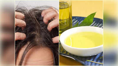 Neem Oil For Hair: এই ১টি কারণে গরমকালেও মাথায় ভরে যায় খুশকি, ঠিক এভাবে নিম তেল মাখলে ৩ সপ্তাহে মুশকিল আসান