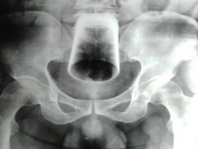 x ray