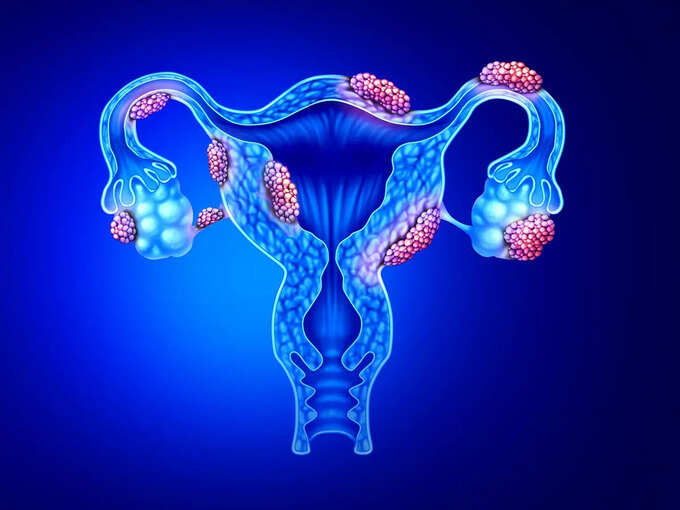 ​anti-müllerian hormone (AMH)​