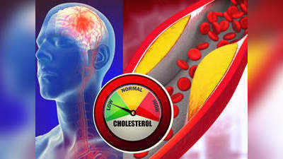 high cholesterol : இந்த 4 அறிகுறிகள் உங்களுக்கு இருந்தா உயர் கொலஸ்டிரால் பிரச்சினை ஆரம்பம்னு அர்த்தமாம்...