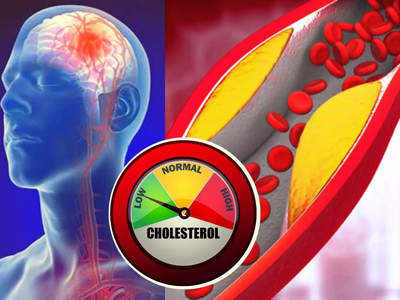 high cholesterol : இந்த 4 அறிகுறிகள் உங்களுக்கு இருந்தா உயர் கொலஸ்டிரால் பிரச்சினை ஆரம்பம்னு அர்த்தமாம்...