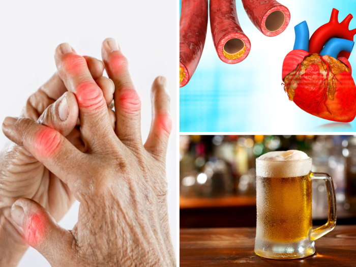 4 signs and symptoms of high cholesterol you can see in your fingers, know 5 easy ways to reduce bad cholesterol naturally