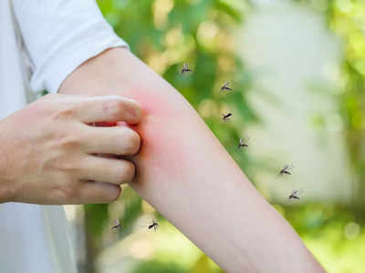 Mosquitoes :  దోమలు కుట్టొద్దొంటే వీటిని రాయండి..