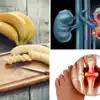 banana prevent kidney stones and cherry uric acid level know your