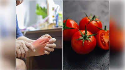 Tomatoes and Uric Acid: ইউরিক অ্যাসিড বেশি থাকলে কি টমেটো খাওয়া উচিত নয়? সত্যি-মিথ্যে জেনে সাবধানে থাকুন