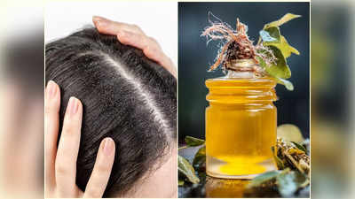 Hair Oiling For Dandruff: মাথায় তেল মাখলেই কমে খুশকি? উত্তর দিলেন বিশিষ্ট চিকিৎসক