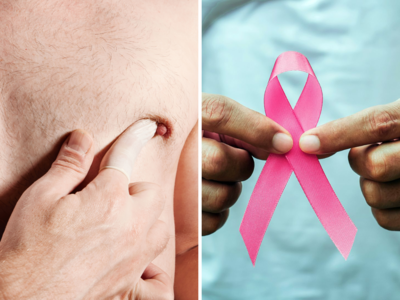 Male Breast Cancer Symptoms: पुरुषों में ऐसा डिस्चार्ज होना है ब्रेस्ट कैंसर की निशानी, ना करें नजरअंदाज
