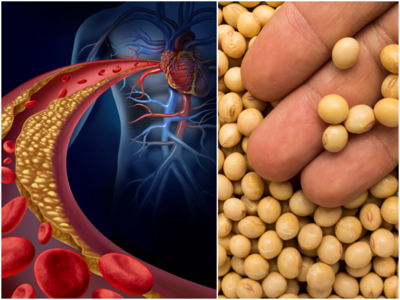 Good Cholesterol: ఇవి తింటే.. మంచి కొలెస్ట్రాల్‌ పెరగమే కాదు, గుండెకు కూడా మంచిది..!