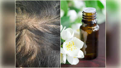 Oils For Hair Loss: চুল পাতলা হতে হতে মাথার সামনে টাক? জেনে নিন কোন তেল মালিশে কমবে চুল পড়া