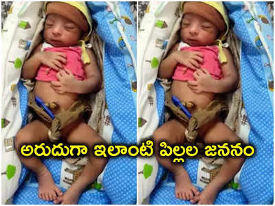 Korutla Baby: కోరుట్ల ప్రభుత్వాసుపత్రిలో అరుదైన శిశువు జననం