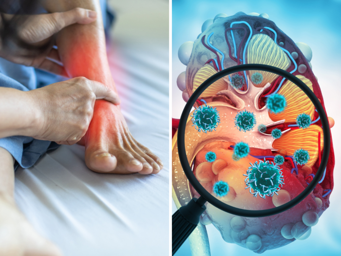 Tingling Sensation In Legs Caused Due To Kidney Problem Diabetes tingling-sensation-in-legs-caused-due-to-kidney-problem-diabetes