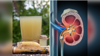 Sugarcane Juice Benefits: पथरी-पीलिया के लिए नैचुरल टॉनिक है गन्ने का रस, मगर ये 5 लोग न करें पीने की गलती