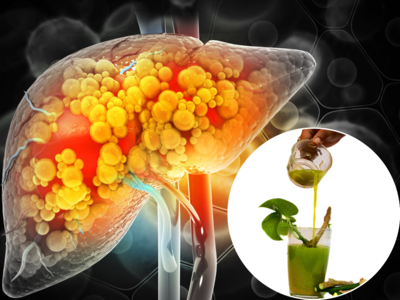 Liver Cleansing Herbs : लिव्हरमध्ये साचलेल्या विषारी पदार्थांना खेचून बाहेर फेकून देतील हे ५ आयुर्वेदिक हर्ब्स
