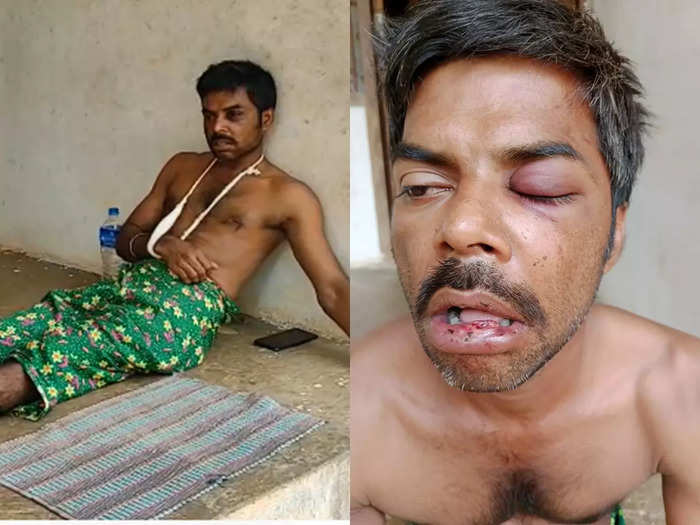 mentally challenged youth was attacked by mob in kozhikode