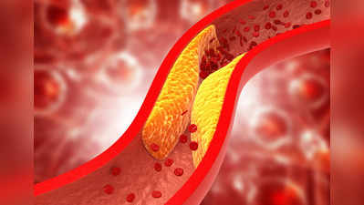 Lower Cholesterol: వేసవిలో ఈ 5 ఫుడ్స్‌ తింటే.. కొలెస్ట్రాల్‌ కరుగుతుంది..!