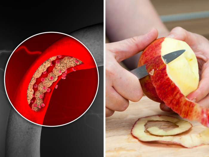 how to lower bad cholesterol quickly from body with foods and diet