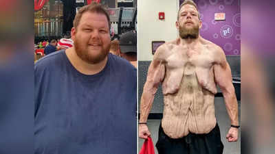 Body  Transformation: बंदे ने घटाया 150 किलो से ज्यादा वजन, शर्टलेस तस्वीर इंटरनेट पर वायरल हो गई