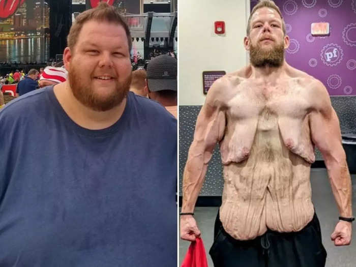 viral body transformation man lost a huge 152 kilos now his shirtless photo goes viral on internet