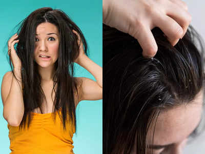 Oily Hair in Summer: ઉનાળામાં ચીકણા અને શુષ્ક-બેજાન વાળ, ઓઇલી સ્કાલ્પની સમસ્યા દૂર કરશે આ 10 સિમ્પલ ટિપ્સ