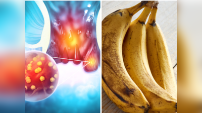 Banana For Piles: पुरानी से पुरानी बवासीर-कब्ज को जड़ से मिटा देगा केला, आयुर्वेद Dr ने बताया कब-कितने केले खाएं