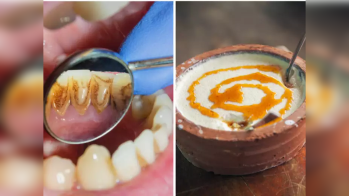 How Remove Teeth Plaque : पिवळेधम्मक दातही चमकतील हि-यासारखे चकचकीत, फक्त करा 2 मिनिटाचे हे 6 सोपे घरगुती उपाय