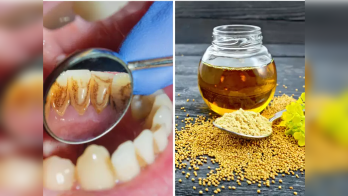 Teeth Whitening Remedy : दातांवरचा पिवळा घाणेरडा थर होईल झटक्यात साफ, हि-यांसारखी चमकेल बत्तीशी, करा हे 4 उपाय