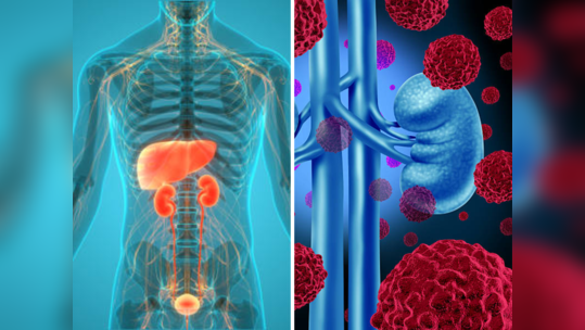 ८ लक्षणांकडे दुर्लक्ष करणे वाढवेल किडनीच्या कॅन्सरचा धोका, टाळाटाळ करणे पडेल भारी
