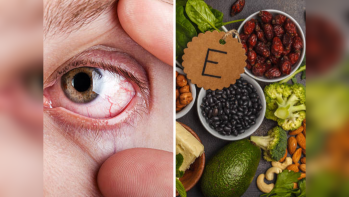 Best Foods For Eyes : डोळ्यांची जळजळ होते, धुसर दिसतंय.. न्यूट्रिशनिस्टने सांगितलेल्या १० पदार्थांचा करा समावेश