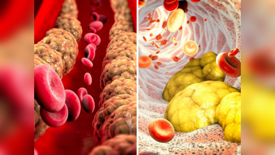 तोंड न धुता खा ४ पदार्थ, रक्तातील घाणेरडे कोलेस्ट्रॉल झर्रकन होईल कमी