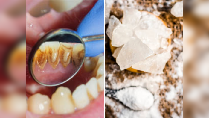 दाताच्या पिवळेपणापासून ते तोंडाच्या दुर्गंधीपर्यंत गुणकारी ठरेल तुरटी, असा करा सोप्या पद्धतीने वापर
