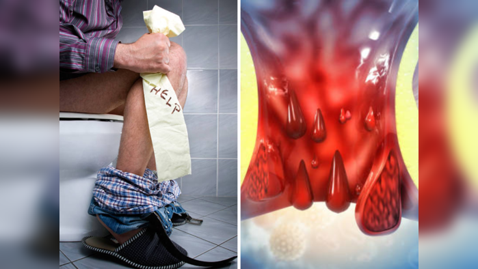 Constipation ​Home Remedies: ना औषध ना पथ्य, घरातल्या या गोष्टींनीच करा बद्धकोष्ठतेचा त्रास दूर, सकाळी एकदम ok..