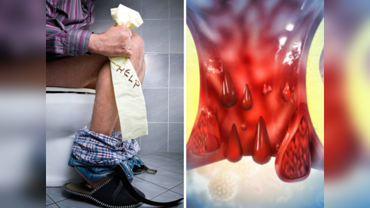 Constipation ​Home Remedies: ना औषध ना पथ्य, घरातल्या या गोष्टींनीच करा बद्धकोष्ठतेचा त्रास दूर, सकाळी एकदम ok..