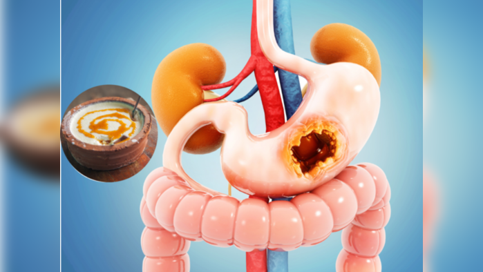 Colon Cleansing : आतड्यांचा पीळ सुटून फसलेली घाण करतात मुळापासून साफ, पचनशक्ती वाढवतात डॉक्टरचे हे 5 सोपे उपाय