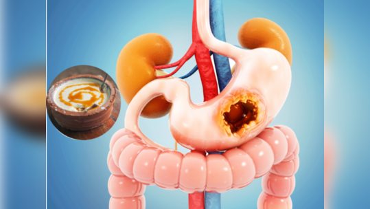 Colon Cleansing : आतड्यांचा पीळ सुटून फसलेली घाण करतात मुळापासून साफ, पचनशक्ती वाढवतात डॉक्टरचे हे 5 सोपे उपाय