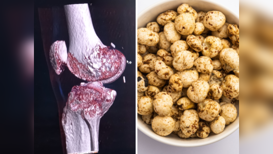 Lotus Seeds: एका झटक्यात वेटलॉस व स्लिम कंबर देणारा हा पदार्थ हाडे करतो टणक, शरीरात ठासून भरतं प्रोटीन-कॅल्शियम