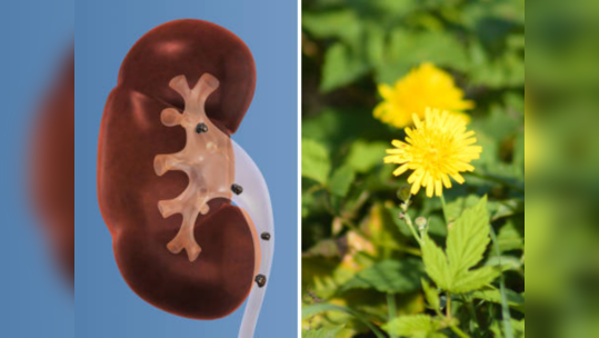 Kidney Stone वर रामबाण घरगुती उपाय, सेवन करताच मुतखडा फुटून लघवीवाटे निघून जाईल