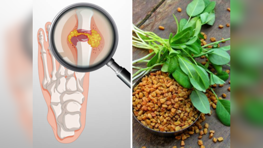 सांध्यांमध्ये जमा झालेल्या क्रिस्टल युरिक अ‍ॅसिडला मुळापासून उपटून काढेल मेथी, ३ पद्धतीने करा सेवन