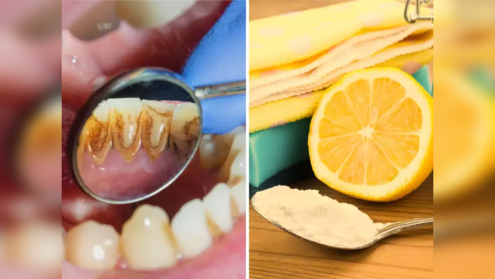 20 रूपयांचे हे 2 पदार्थ दातांवरचा पिवळा थर करतात मिनिटात साफ, ब्रश न करता मोत्यांसारखा चमकतो दातांचा कानाकोपरा