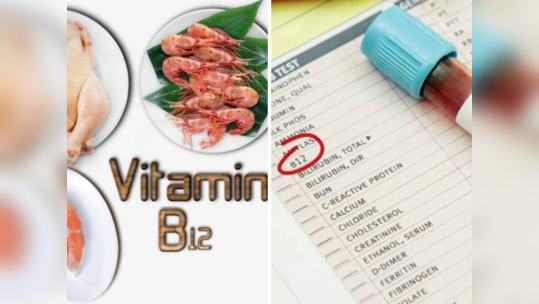 वयाप्रमाणे शरीरात किती असावी Vitamin B12 ची पातळी? गंभीर आजापासून वाचण्यासाठी पाहा चार्ट