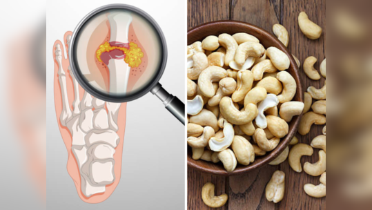 लोखंडाप्रमाणे टणक हाडे होण्यासाठी असे खा काजू, काही दिवसातच दिसेल फरक