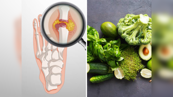 आर्थरायटिस होईल त्वरीत दूर ५ पदार्थांचा करून घ्या आहारात समावेश, युरिक अ‍ॅसिड होईल छुमंतर