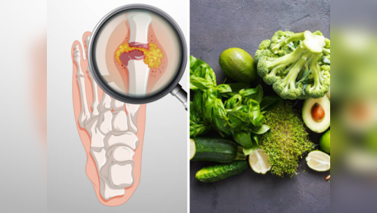 आर्थरायटिस होईल त्वरीत दूर ५ पदार्थांचा करून घ्या आहारात समावेश, युरिक अ‍ॅसिड होईल छुमंतर
