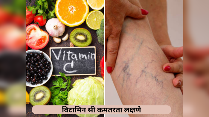 Vitamin C च्या कमतरतेमुळे शरीर पडेल काळेनिळे, आजच आहारात समाविष्ट करा हे पदार्थ