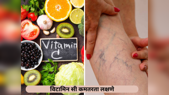 Vitamin C च्या कमतरतेमुळे शरीर पडेल काळेनिळे, आजच आहारात समाविष्ट करा हे पदार्थ