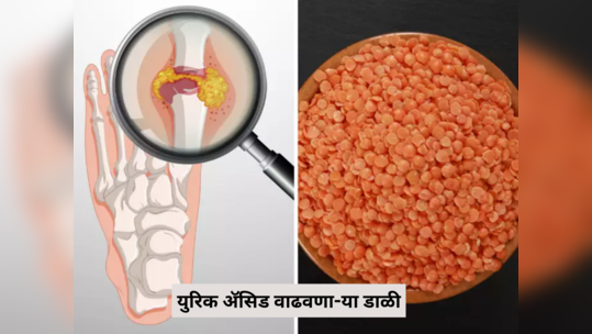 या 5 डाळी खाणं आजच सोडा नाहीतर 100% वाढणार Uric Acid, मुतखडा, गुडघेदुखी, संधिवाताने जागेला खिळण्याआधी व्हा सावध