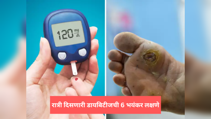 Diabetes Night Symptoms: रात्री गाढ झोपेत दिसतात डायबिटीजची ही 6 भयंकर लक्षणं, रात्री तडफडण्याआधीच करा हे काम