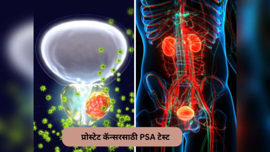 प्रोस्टेट कर्करोगाच्या निदानासाठी PSA चाचणी, पुरुषांना माहीत असायलाच हवे