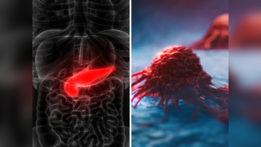 स्वादुपिंडाच्या कर्करोगाचा वाढता धोका, लक्षणे, कारणे आणि उपचार माहीत असणे आवश्यक